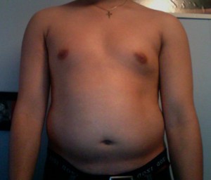 Fat Derek Before and after Ketogenic Diet Weight Loss
